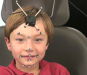 A young boy has nodes applied to his face in the Speech Physiology Lab in the School of Speech, Language and Hearing Sciences.