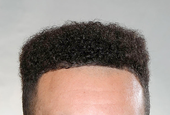 If you don't recognize this distinctive hairline, you're not a basketball fan.